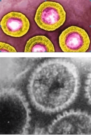 Вирус герпеса в микроскоп - фото