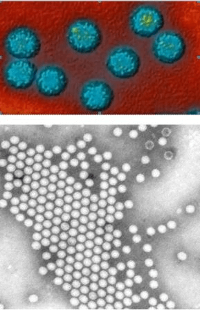 Вирус полиомиелита в микроскоп - фото