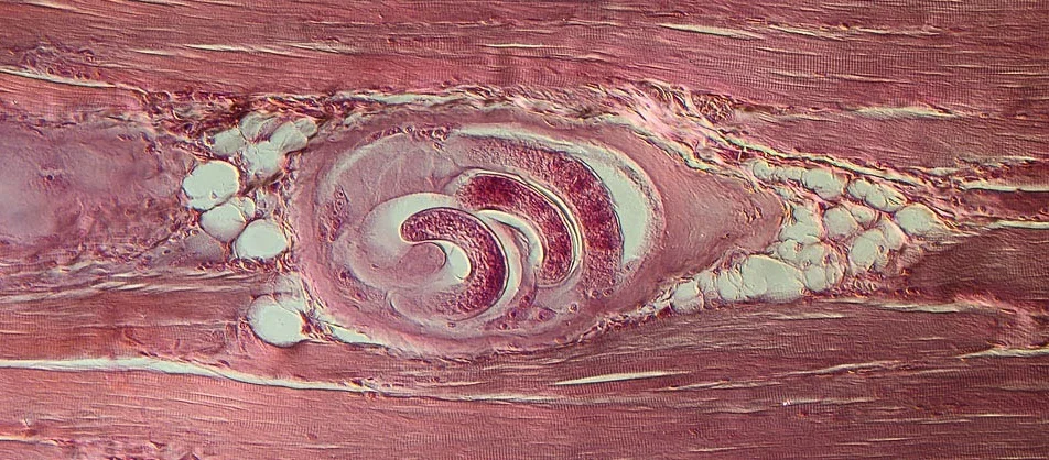 904_Trichinella02_1.jpg