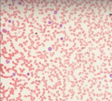 Клетки крови человека под микроскопом 