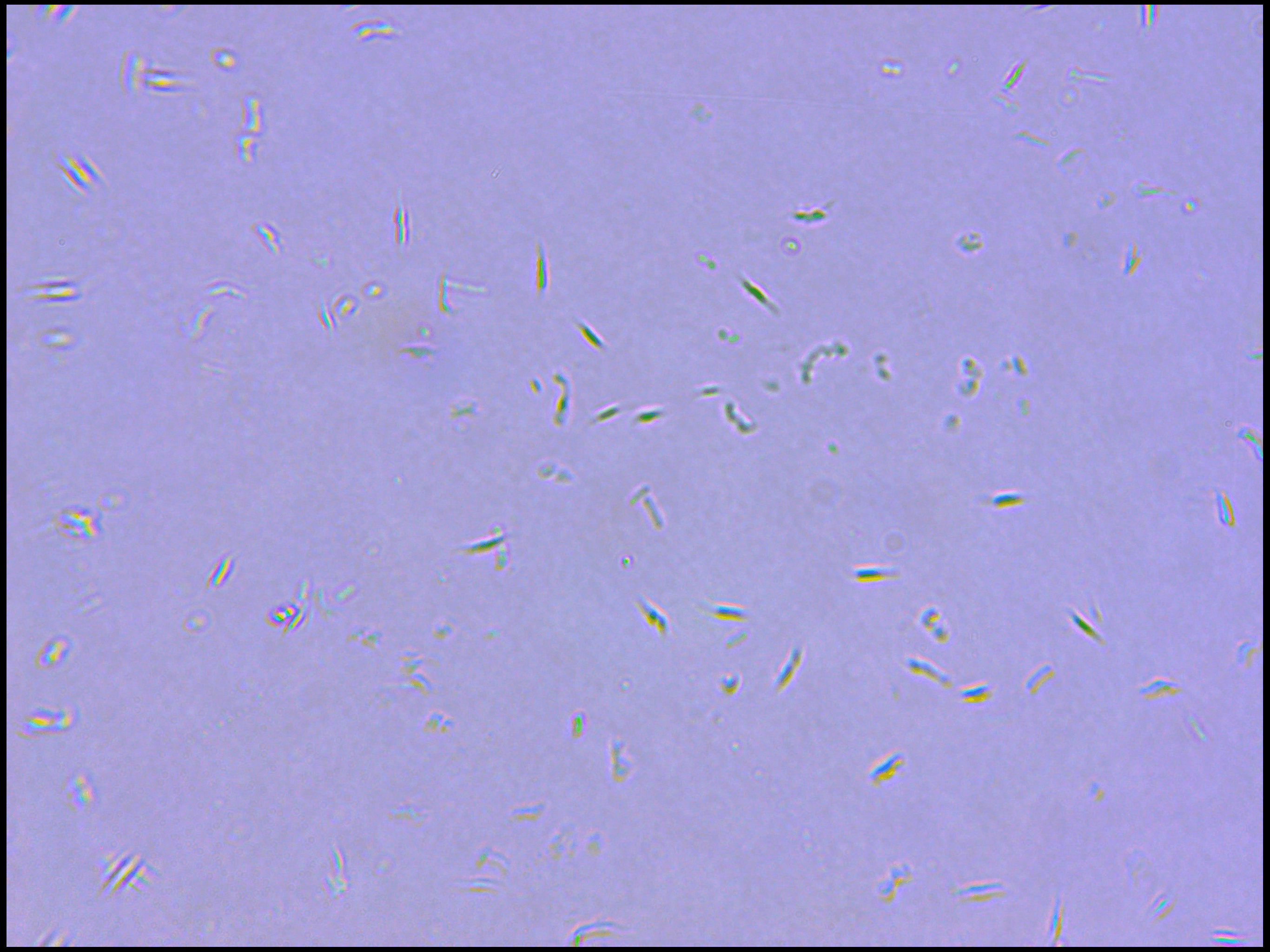 Бактерии под микроскопом: война с мылом