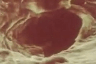 сальная железа под микроскопом