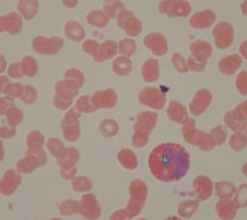 Структура клеток крови через мощный микроскоп