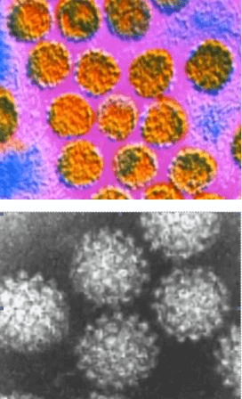 Вирус папилломы в микроскоп - фото