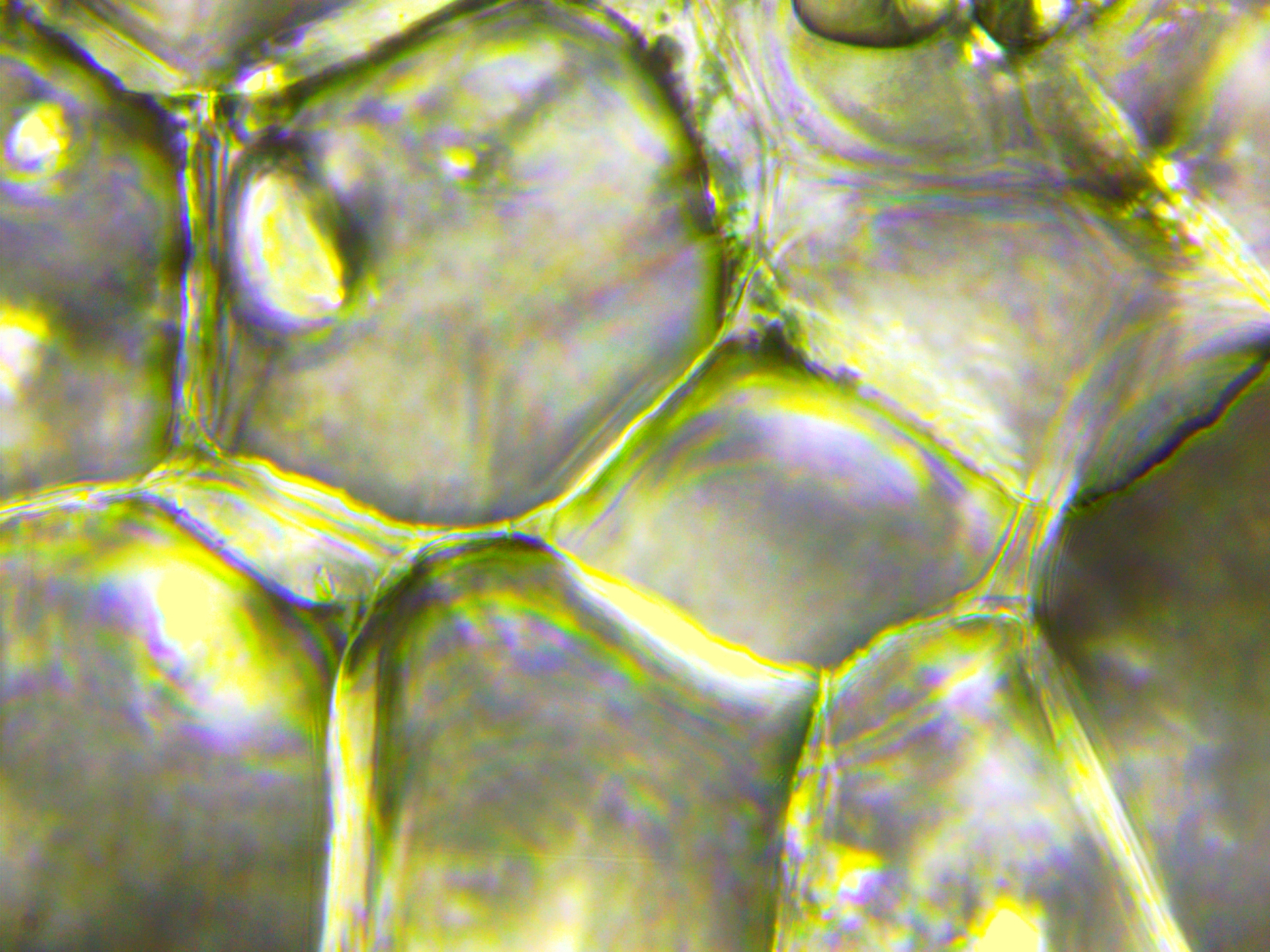 413 - Картоф-40х.jpg