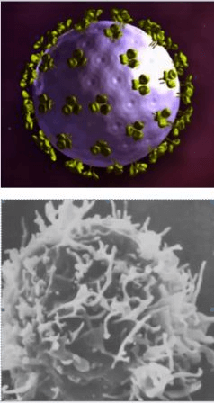 Вирус ВИЧ в микроскоп - фото