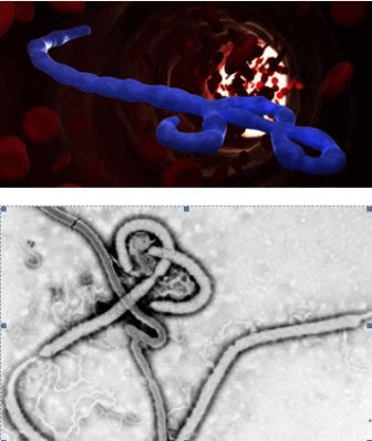Вирус эбола в микроскоп - фото