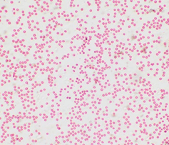 Клетки крови при минимальном увеличении микроскопа