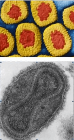 Вирус оспы в микроскоп - фото