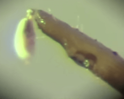 Присоски клеща через микроскоп