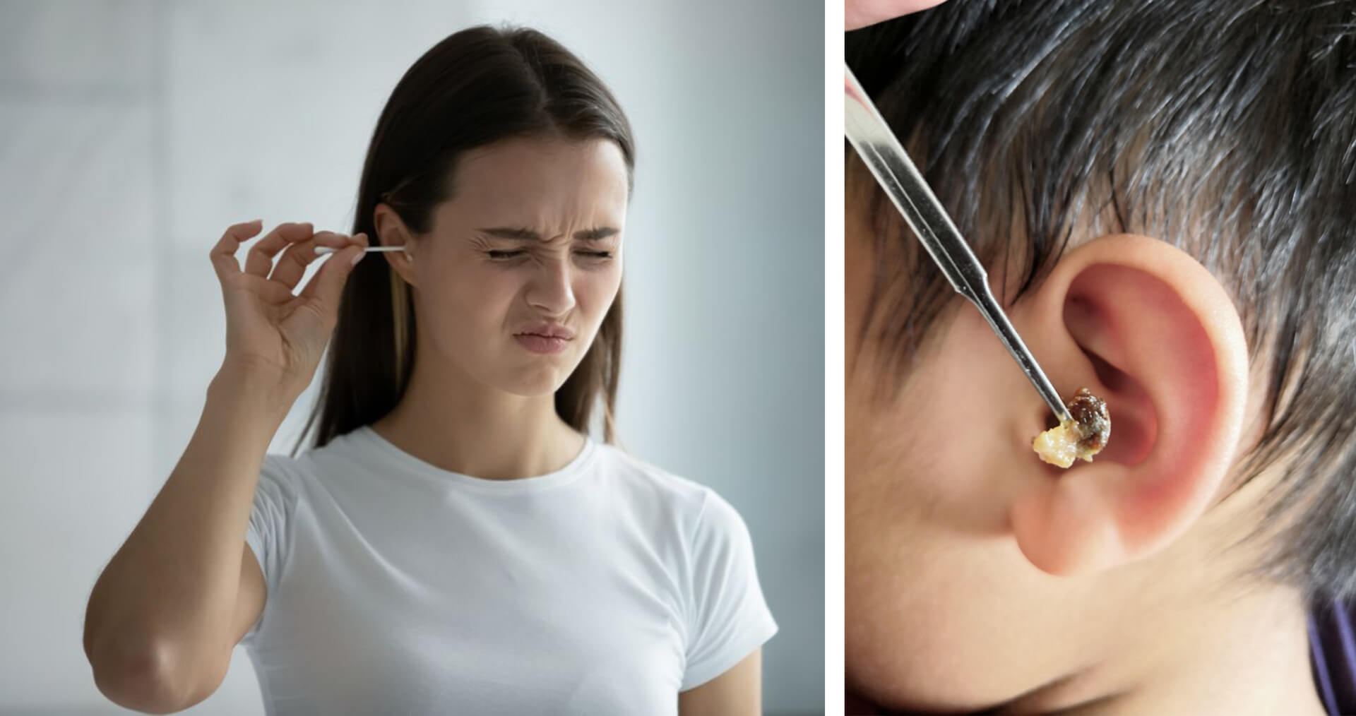 Как удалить серную пробку из уха ребенка и взрослого. Действия врача — клиника «Добробут»