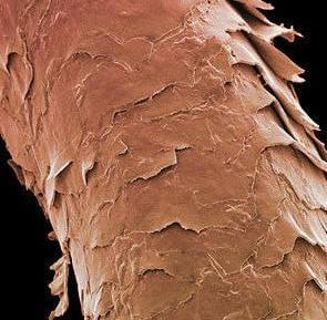 больной волос под микроскопом