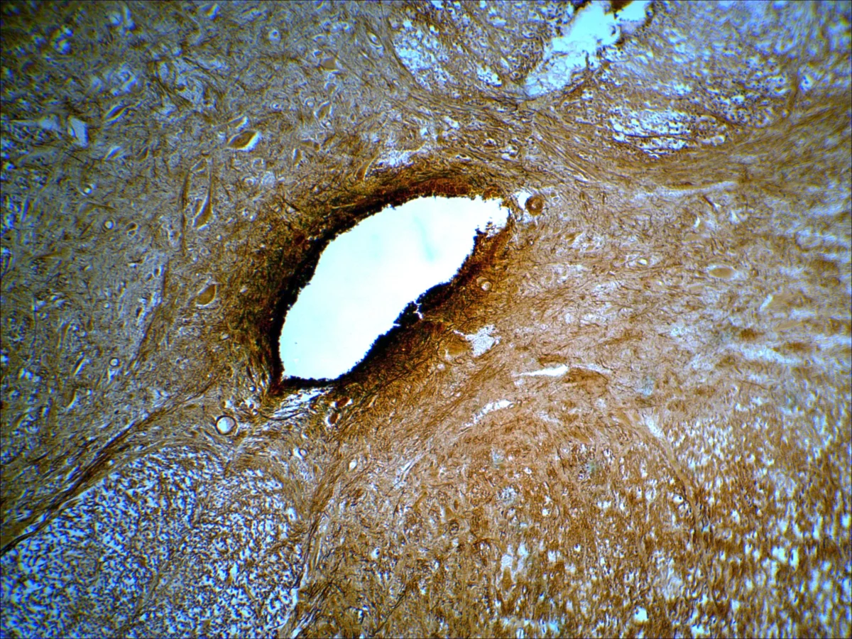 Видеоокуляр DCM-510 SCOPE