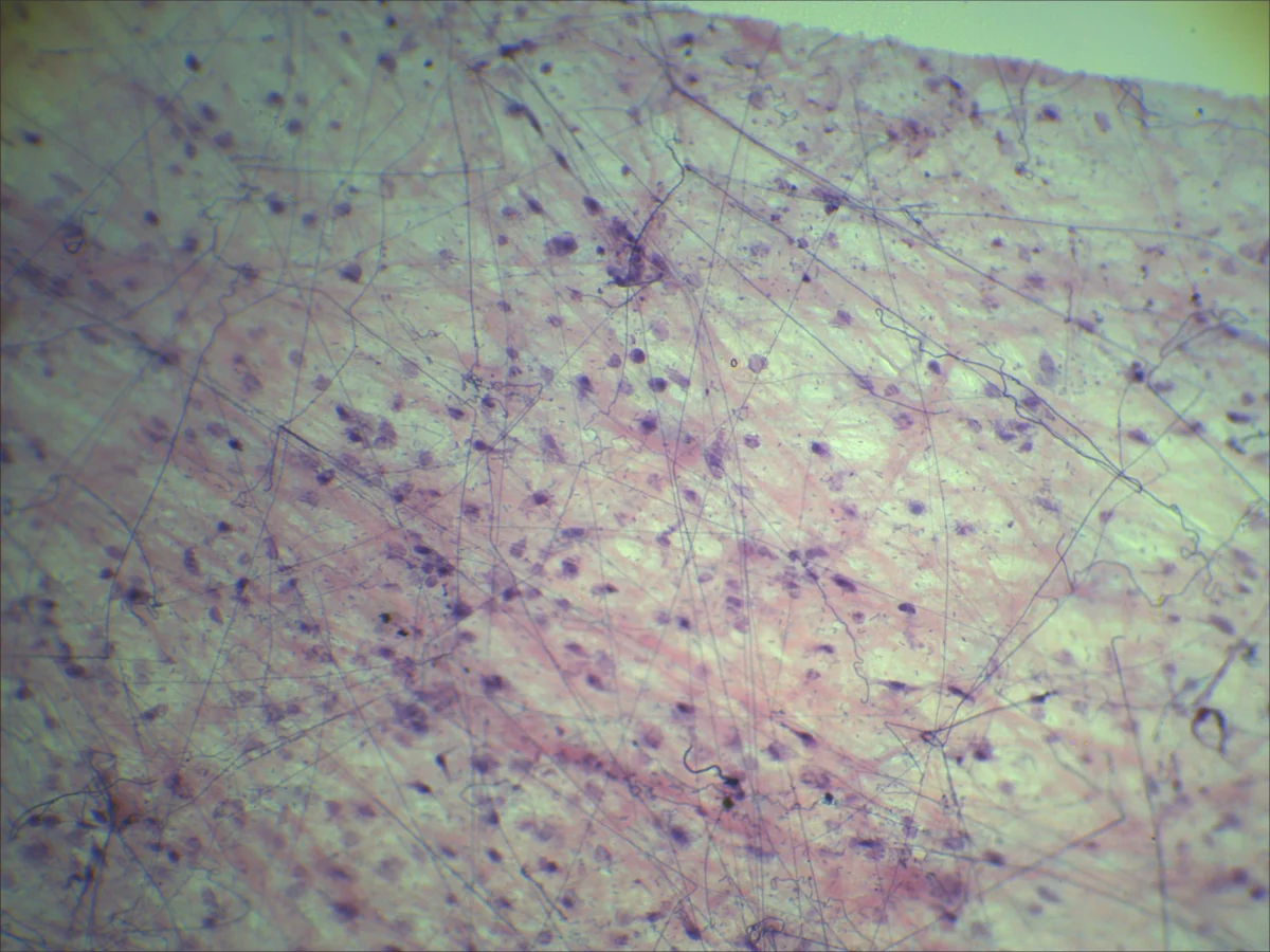Видеоокуляр DCMС-510 SCOPE