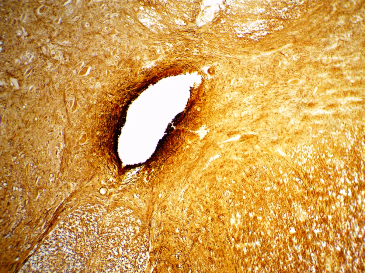 Видеоокуляр ToupCam 3.1 MP