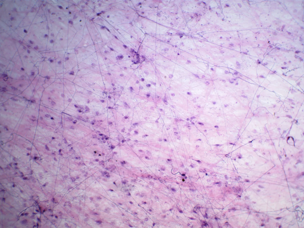 Видеоокуляр ToupCam 3.1 MP