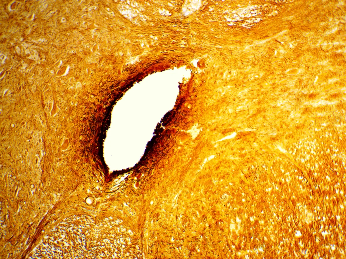 Видеоокуляр ToupCam 5.1 MP