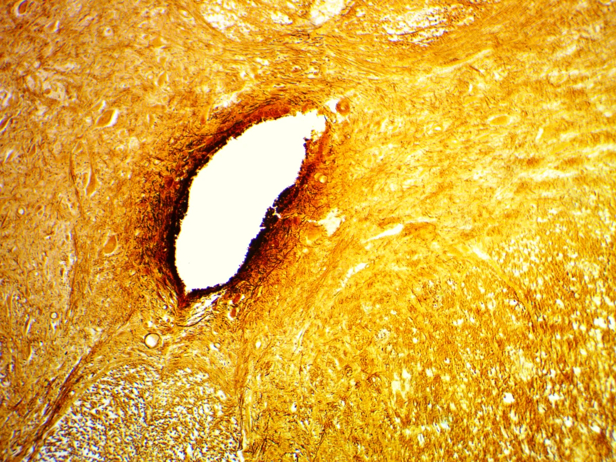 Видеоокуляр ToupCam 9.0 MP